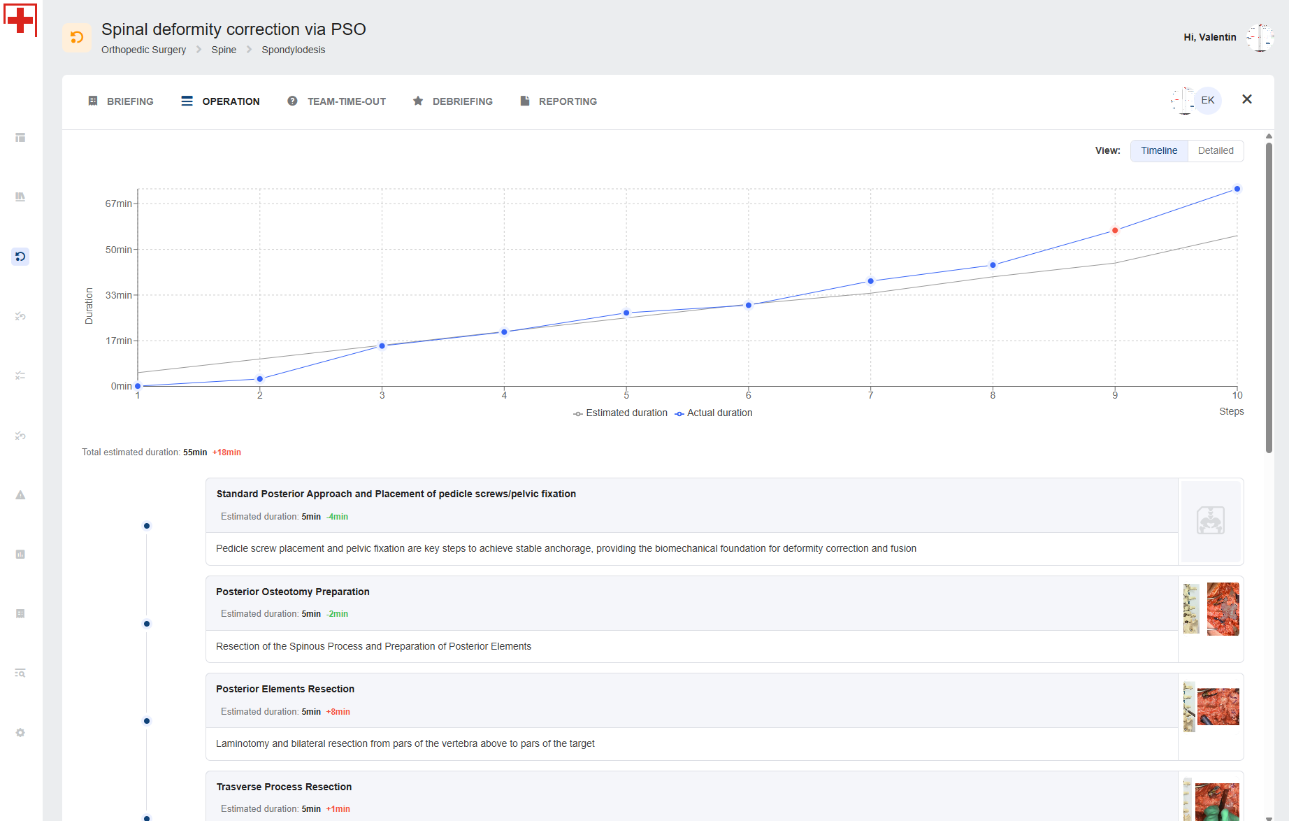 Operation statistics — timeline view