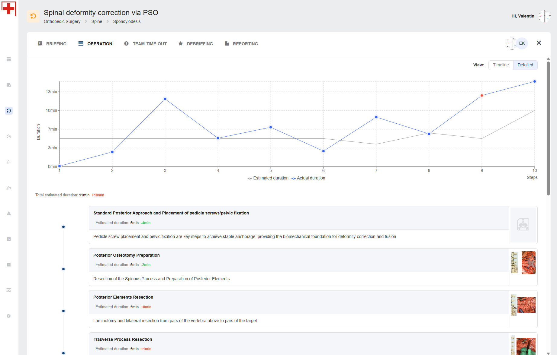 Detailed timeline view